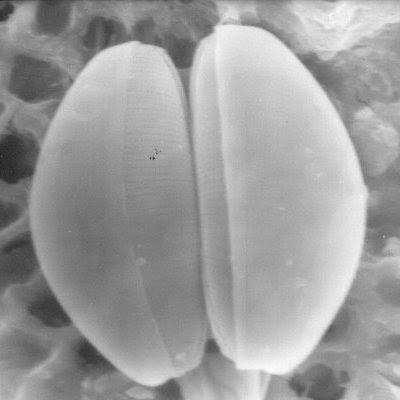 Dos diatomeas de la clase Pennales a microscopio electrónico. Se puede observar cómo la hipoteca encaja dentro de la epiteca en ambas células.