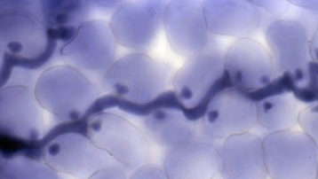 Las formas esféricas oscuras dentro de las células son haustorios de morfología claviforme. Foto de Emmanuel Boutet