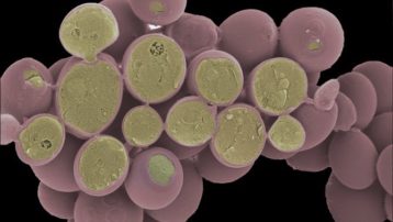 Corte de un grupo de células de Saccharomyces cerevisiae vistas a microscopio electrónico, esta imagen está coloreada artificialmente. (http://www.cellimagelibrary.org/images/40654)