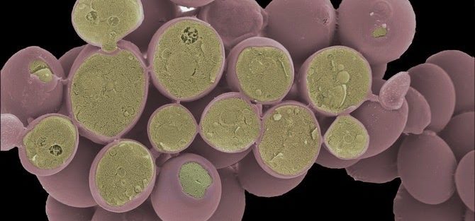 Corte de un grupo de células de Saccharomyces cerevisiae vistas a microscopio electrónico, esta imagen está coloreada artificialmente. (http://www.cellimagelibrary.org/images/40654)