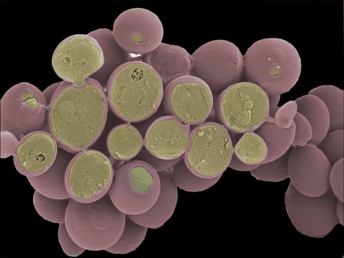 Corte de un grupo de células de Saccharomyces cerevisiae vistas a microscopio electrónico, esta imagen está coloreada artificialmente. (http://www.cellimagelibrary.org/images/40654)