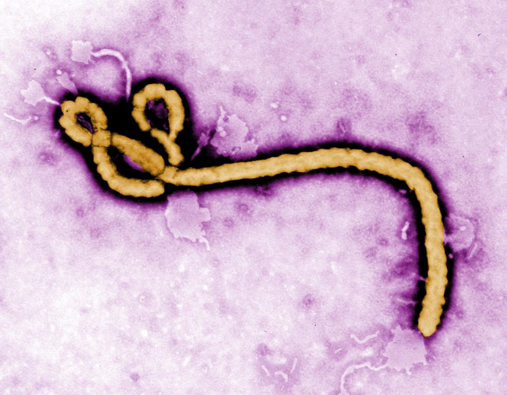 Microfotografía del virus del ébola realizada con microscopía de transmisión (TEM). Los virus pueden adoptar formas inusuales y complejas, variables en forma, tamaño y distribución de proteínas de membrana.