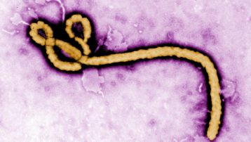 Microfotografía del virus del ébola realizada con microscopía de transmisión (TEM). Los virus pueden adoptar formas inusuales y complejas, variables en forma, tamaño y distribución de proteínas de membrana.