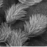 Imagen de microscopio electrónico de barrido del epitelio de la tráquea pulmonar. Hay células ciliadas y no ciliadas en este epitelio. Se aprecia la diferencia de tamaño entre los cilios y las microvellosidades (en la superficie celular no ciliada).