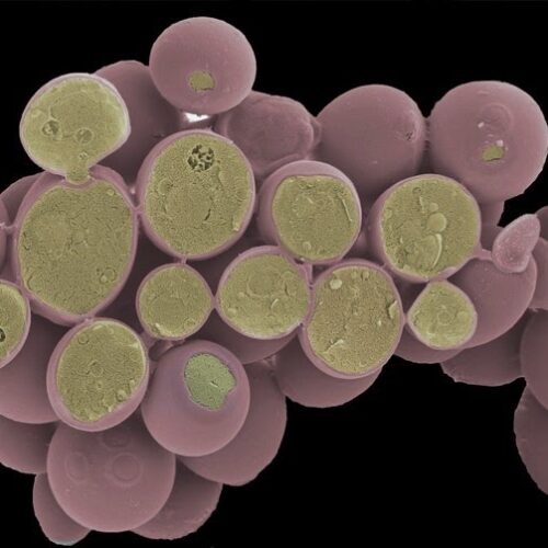 Corte de un grupo de células de Saccharomyces cerevisiae vistas a microscopio electrónico, esta imagen está coloreada artificialmente. (http://www.cellimagelibrary.org/images/40654)