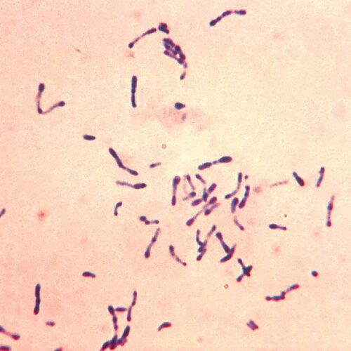 Difteria. Corynebacterium diphtheriae