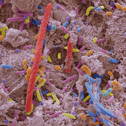 Oral bacteria. Coloured scanning electron micrograph (SEM) of mixed oral bacteria. The mouth contains a large number of bacteria, most of which are harmless or even beneficial. However, some bacteria can cause throat infections or cause the formation of plaque deposits on the teeth, which may lead to decay. Up to 700 species of oral bacteria exist with the average adult having between 30 and 70 different species of bacteria in their mouth. Magnification: x5000 at 10cm high.