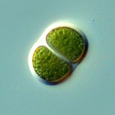 Figura 2: Cianobacteria. Chroococcus sp. © Proyecto Agua: Antonio Guillén https://www.flickr.com/photos/microagua/3407654758