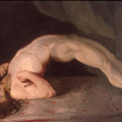 Pintura de Sir Charles Bell (1809) de un paciente sufriendo los espasmos musculares del tétanos.